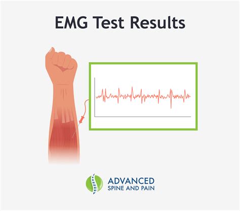 interpreting emg results|interpreting emg ncv results.
